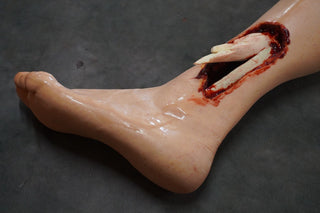 Dura Hugo Leg with Compound Fracture and Packable Wound