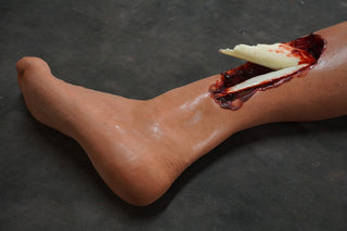 Dura Hugo Leg with Compound Fracture and Packable Wound