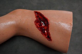 Dura Hugo Leg with Compound Fracture and Packable Wound