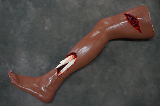 Dura Hugo Leg with Compound Fracture and Packable Wound