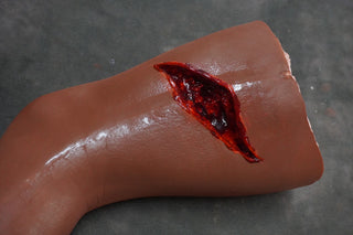 Dura Hugo Leg with Compound Fracture and Packable Wound