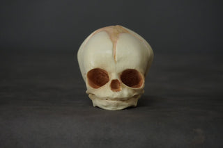 Cast Fetal Skull