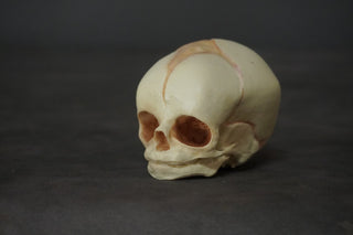 Cast Fetal Skull