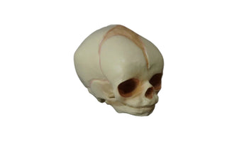 Cast Fetal Skull