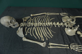 Disarticulated Skeleton with Cast Skull