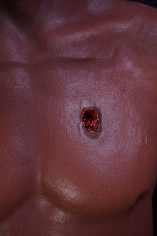 Dura Severe Trauma Richard Body