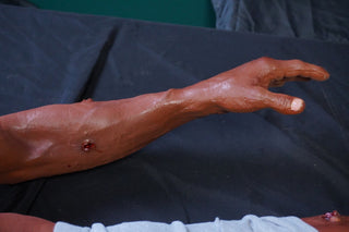 Dura Severe Trauma Richard Body